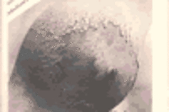 Titelbild: Foto von Brust Großaufnahme