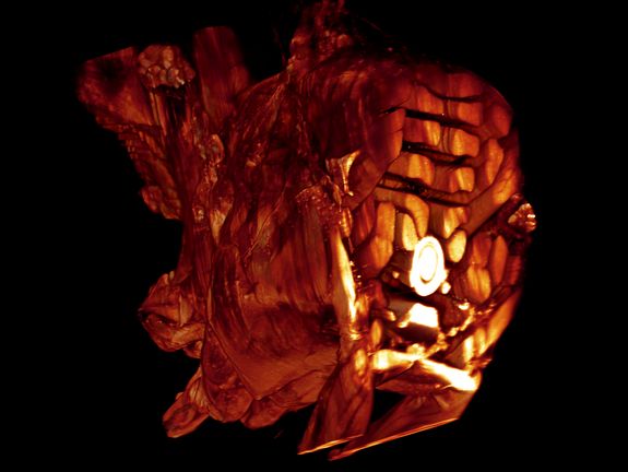 Ultra-microscopic image of a drosophila's thorax