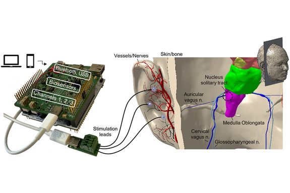 Individualised auricular vagus nerve stimulation at the right time and with the right strength.
